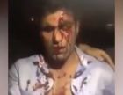 Бойца ММА из Афганистана порезали ножом (Видео) Бойца ММА из Афганистана порезали ножом (Видео)