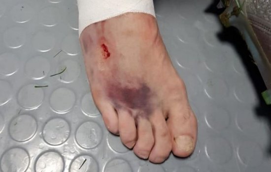 Нога Кутепова