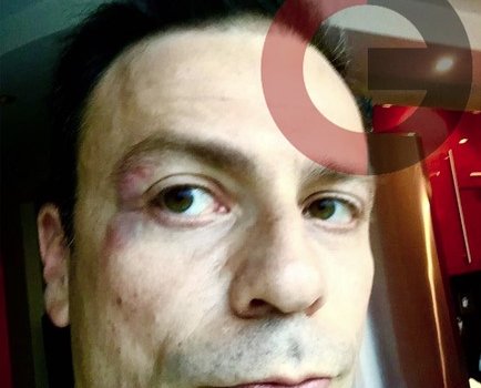 Рабинер получил рукоприкладную "благодарность" от Кирьякова