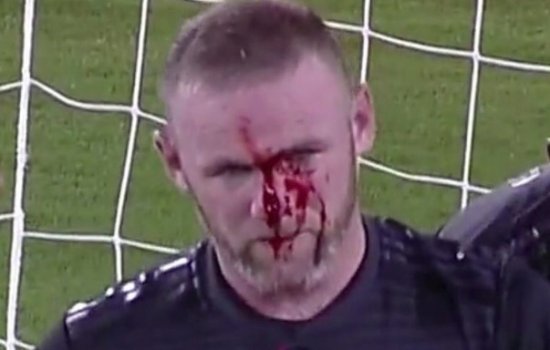 Руни сломали нос в МЛС (Фото)