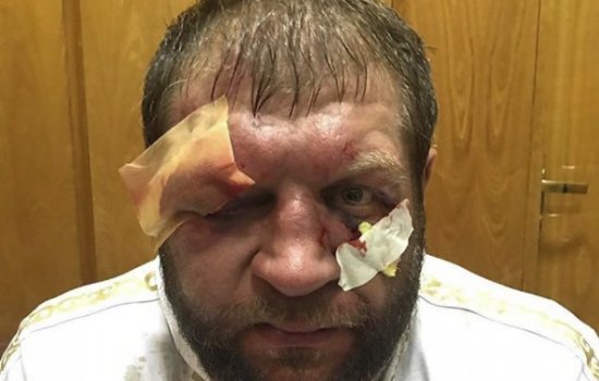 Судьи «подарили» ничью Александру Емельяненко: видео боя