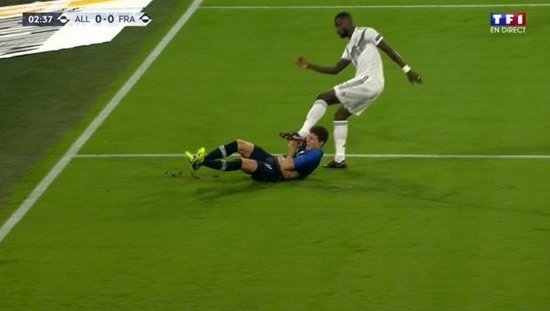 Павару шипами «порезали» шею в матче Германия – Франция: фото, видео