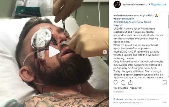 Боец MMA Стивенс остался без глаза после боя с Митчеллом