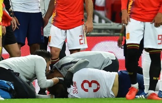 Травма Шоу шокировала зрителей матча Англия – Испания: видео