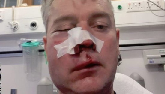 В Ирландии судью Дэниэла Свини «отлупили» после выигранного матча