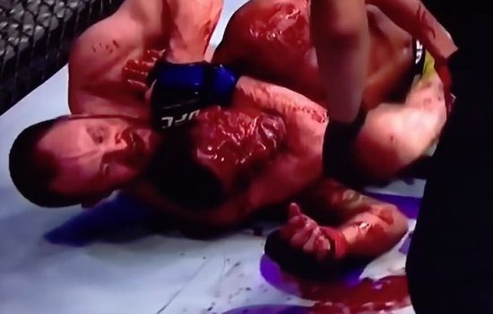 Боец ММА Гуннар Нельсон превратил лицо Оливейры в кровавое месиво (Видео)