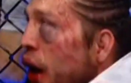 Врачи не пустили Ортегу на 5-й раунд против Холлоуэя: чемпионский бой ММА, обзор (Видео)