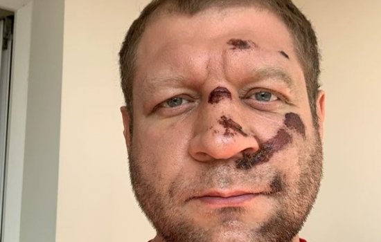 Александр Емельяненко «грохнулся» с велосипеда и пропустит ближайший бой Александр Емельяненко «грохнулся» с велосипеда и пропустит ближайший бой