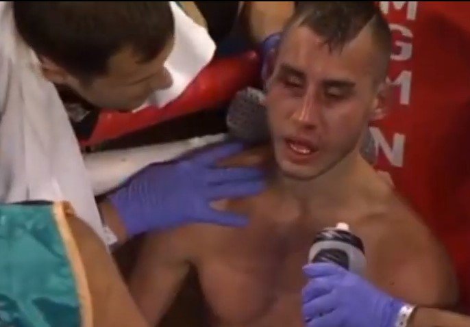 Боксер после удара в затылок инвалид
