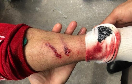 Россия разгромила на выезде Кипр и досрочно вышла на Евро-2020 (обзор)