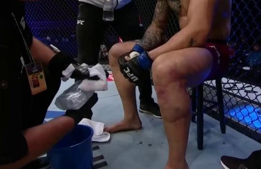 Ракич с опухшей ногой достоял бой в UFC