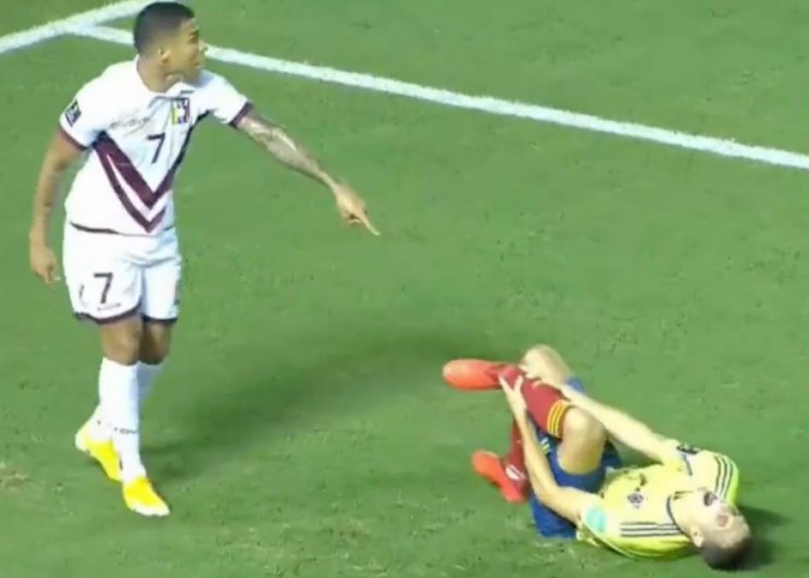 Колумбийскому защитнику Ариасу сломали ногу во время матча (Видео)