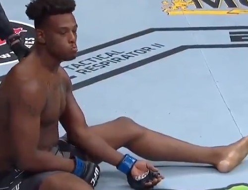 Крэйг за 2 минуты сломал руку Хиллу (UFC, видео) Крэйг за 2 минуты сломал руку Хиллу (UFC, видео)