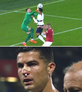 Испания впервые проиграла дома за 19 лет, Роналду разбили нос (Видео)