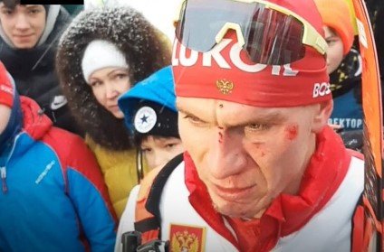 Устюгов «отомстил» Большунову - Саня разбил лицо, оба сошли (Видео)