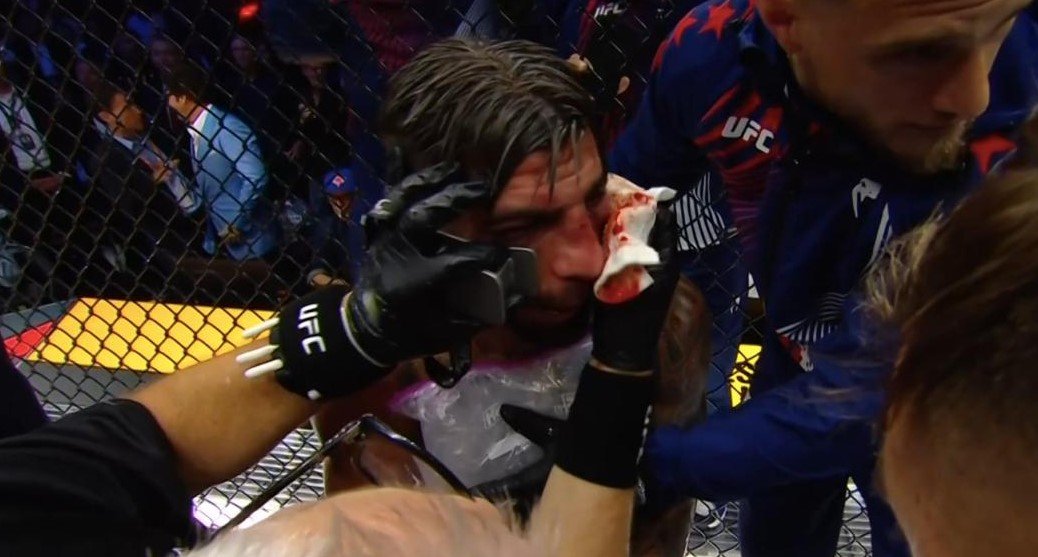 37-летний Гейджи сенсационно отобрал титул UFC в легком весе у Топурии 37-летний Гейджи сенсационно отобрал титул UFC в легком весе у Топурии